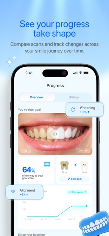 Smyle AI - Teeth Tracker Screenshot 3 of 7
