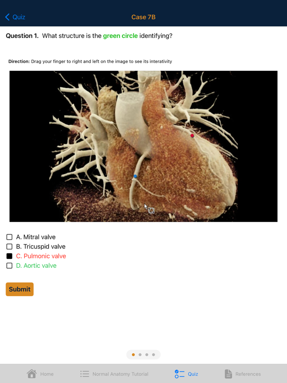 CTisus Chest Atlas 3D CRT iPad screenshot 8 - Medical app