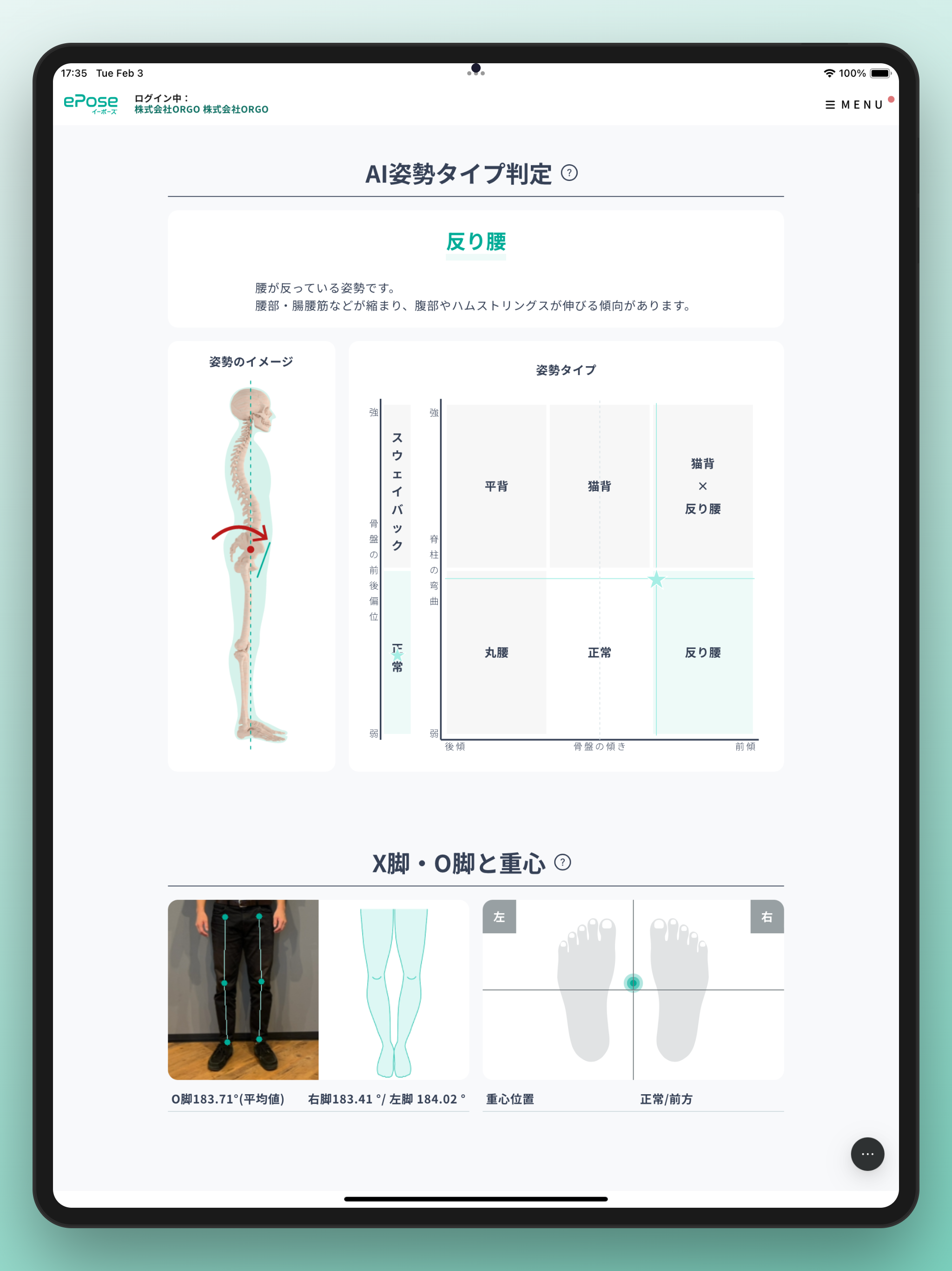 AI姿勢分析アプリePose（イーポーズ）
