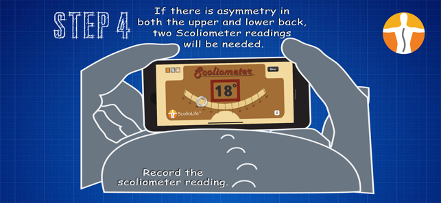 Skoliometer-Screenshot