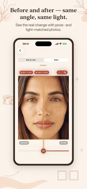 Ruyana: Botox & Filler Tracker screenshot 3