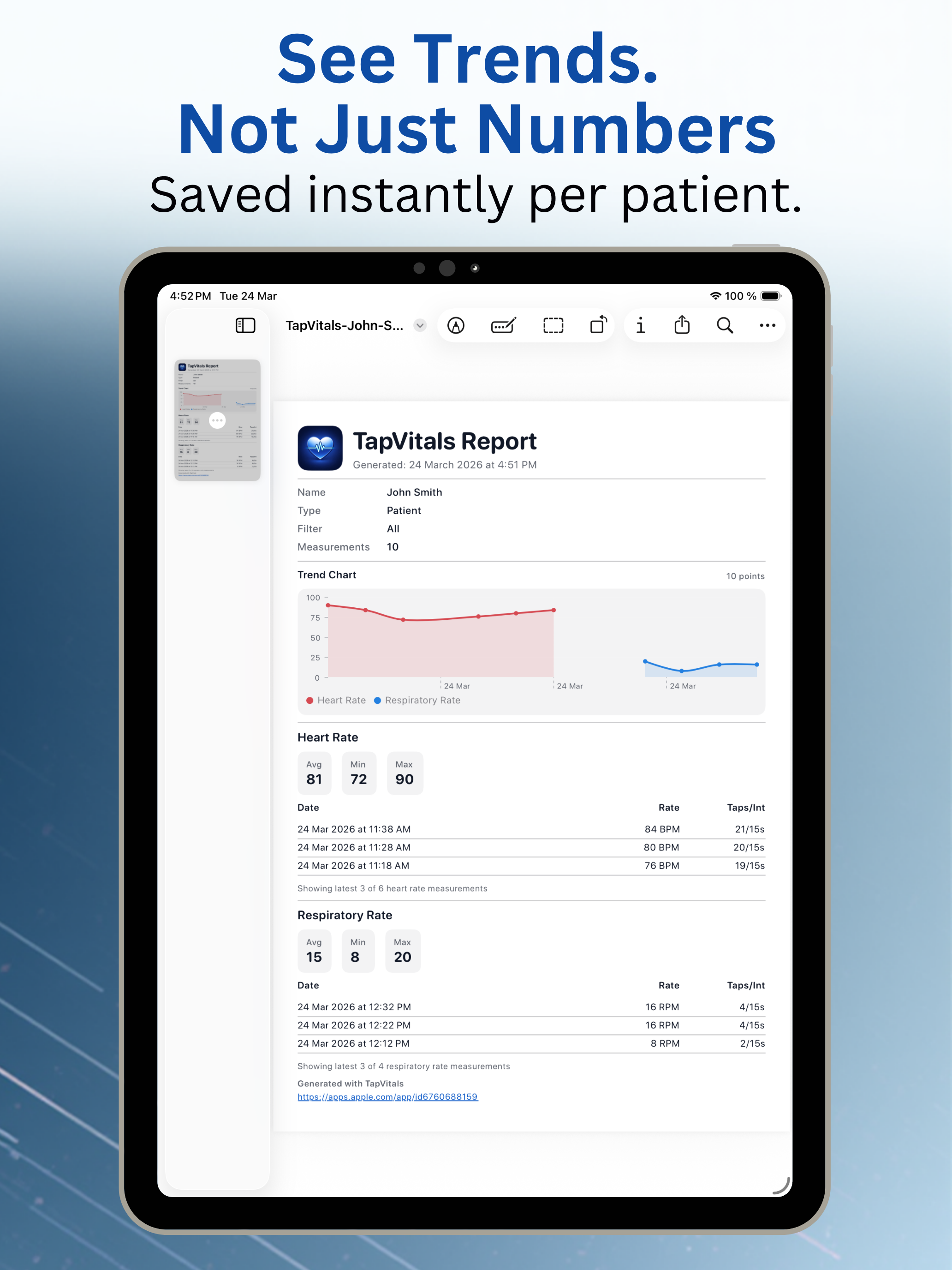 TapVitals: Blood Pressure Log