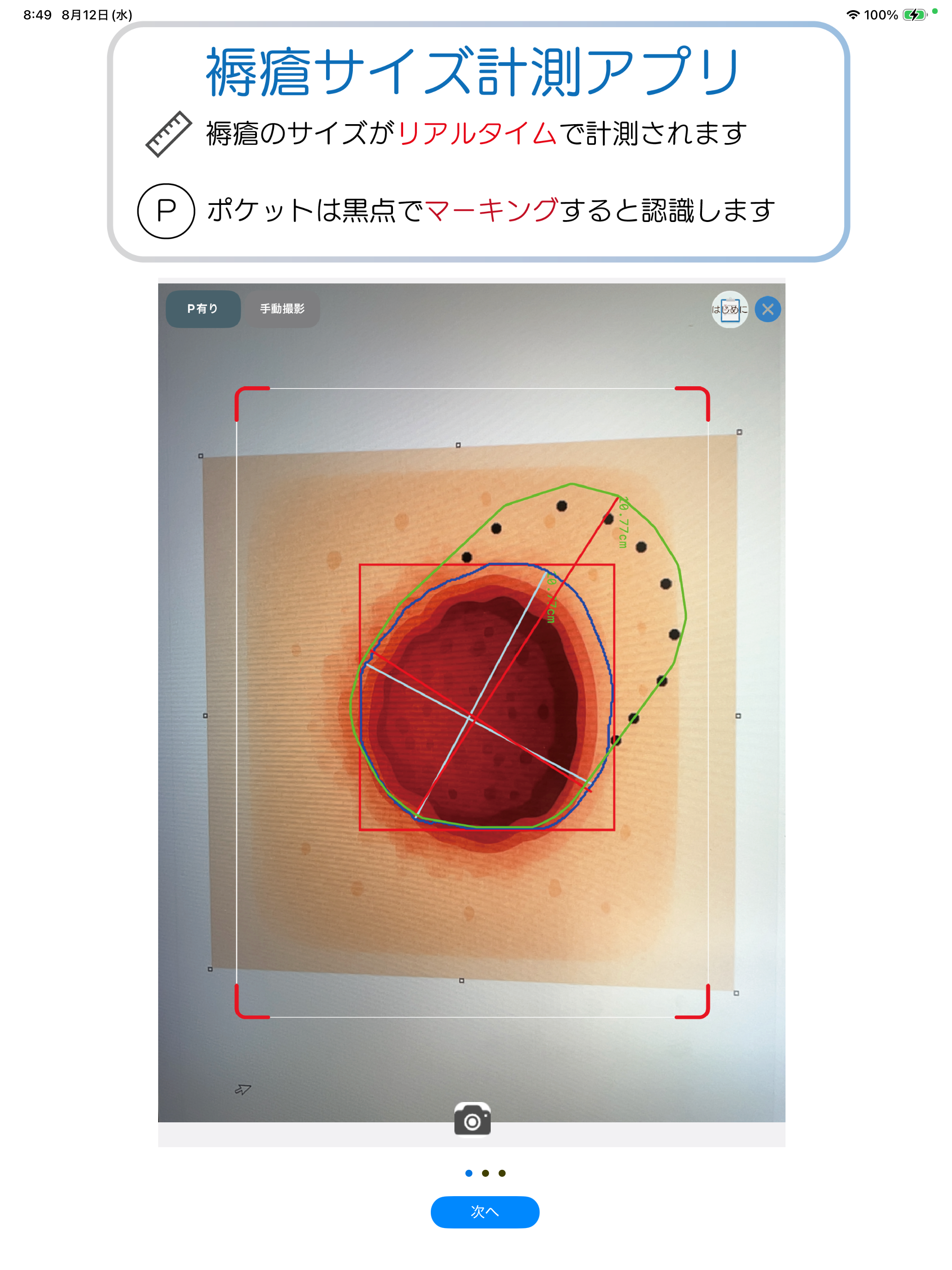 褥瘡Measure screenshot 7