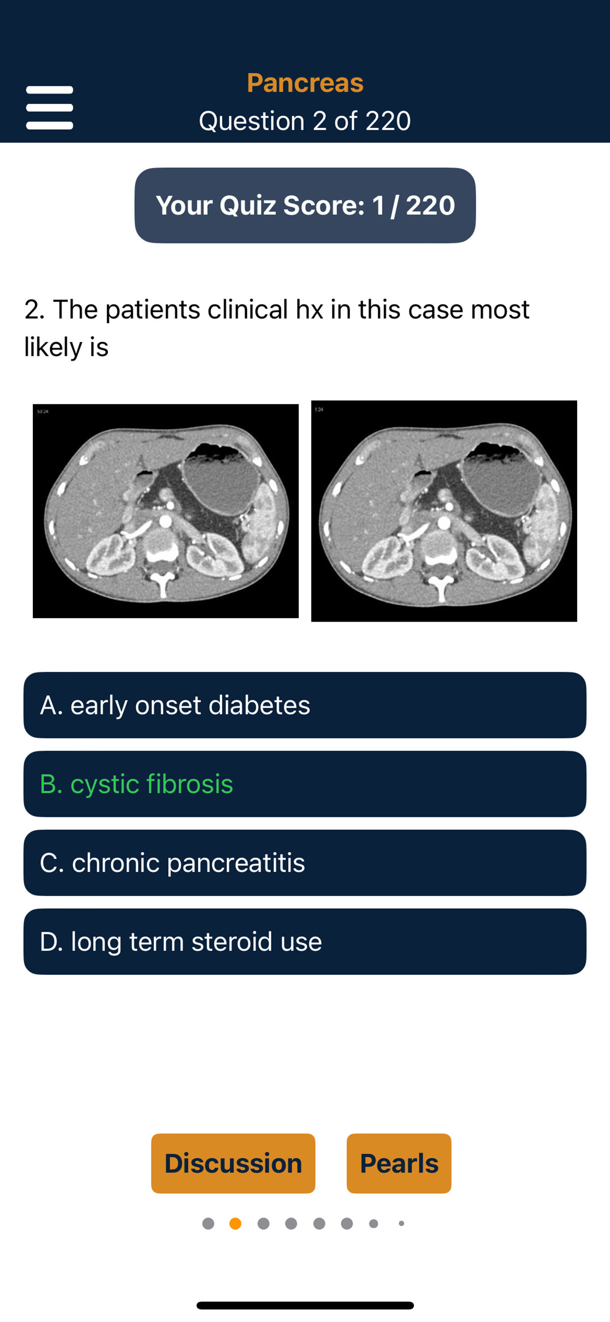 CTisus Pancreas Compendium