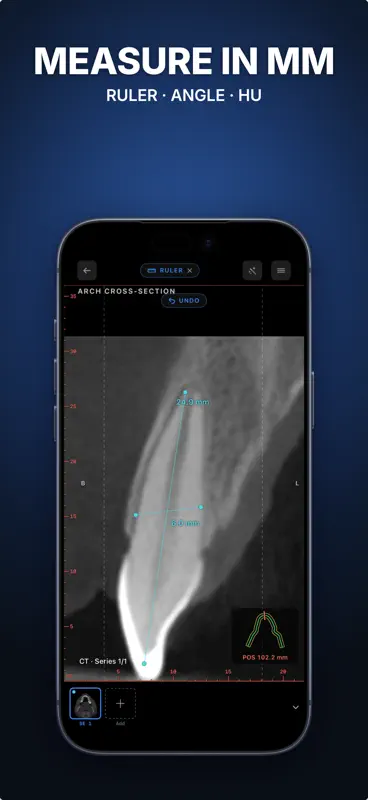 Ossidex: DICOM Viewer CT & MRI screenshot 4 of 6