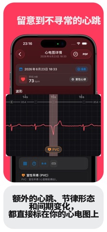 ECG Tracker+ HRV、QTc与趋势 screenshot