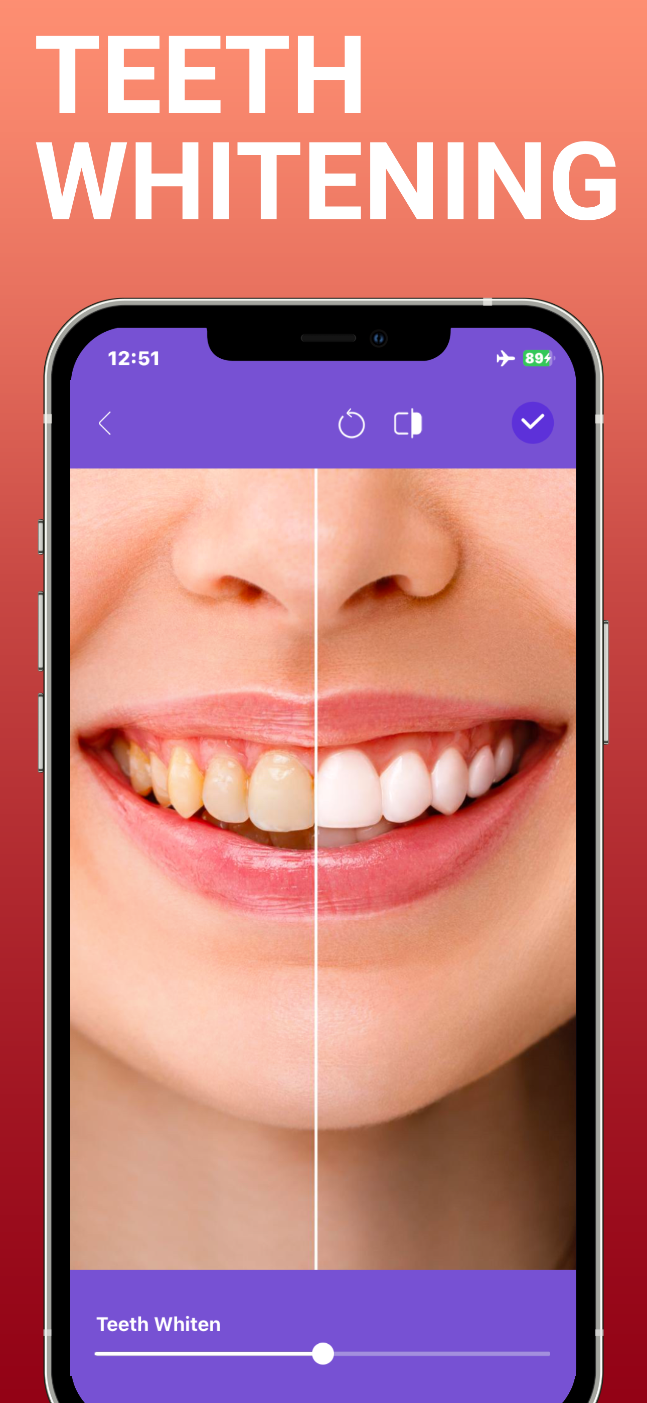 https://is1-ssl.mzstatic.com/image/thumb/PurpleSource221/v4/d9/2f/4e/d92f4ebe-ae3b-00d6-3ddd-7e69f3de7d92/3_scr_teeth_en.png/1290x2796.png