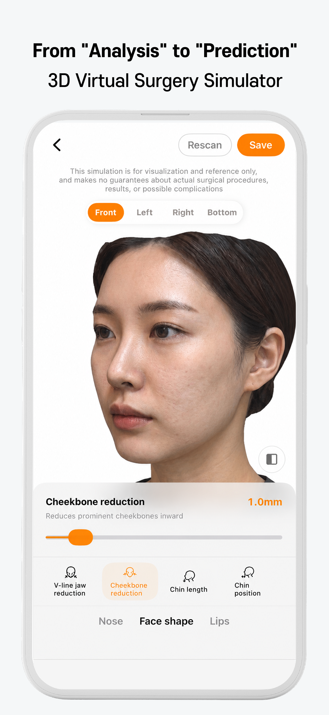 Vlas - Facial Analysis Report screenshot 5