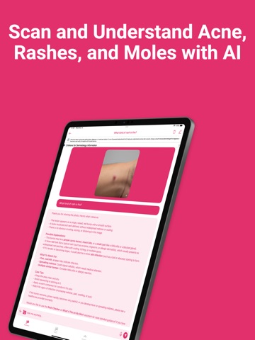 Derma AI: AI for Dermatology iPad screenshot