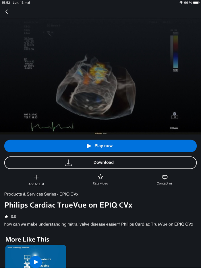 Philips Ultrasound Circle CV