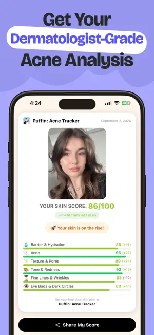 Puffin: Acne Tracker screenshot 2
