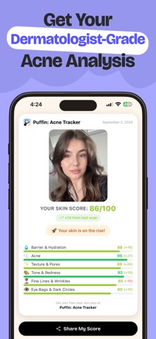Puffin: Acne Tracker Screenshot 2 of 10