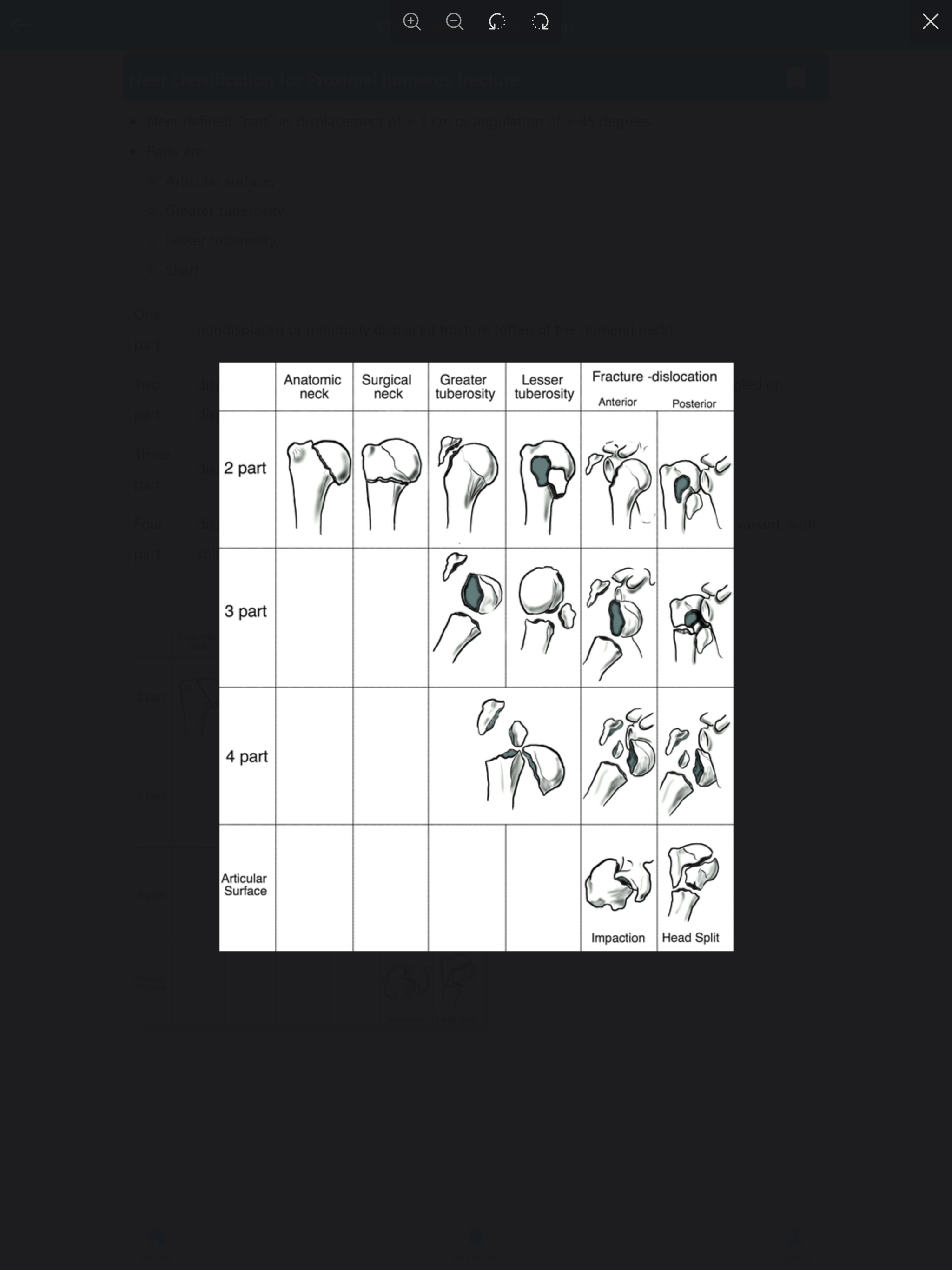 Orthopedic Classification