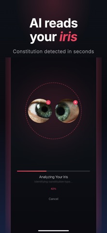 IrisInsight - Iridology AI iPhone screenshot