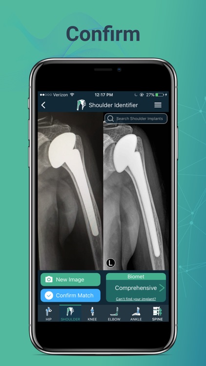 Implant Identifier screenshot-4