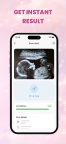 Baby Gender Scanner: Nubbi screenshot