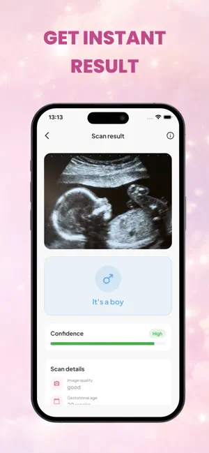 Baby Gender Scanner: Nubbi screenshot 4