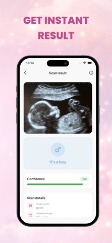 Baby Gender Scanner: Nubbi iPhone screenshot