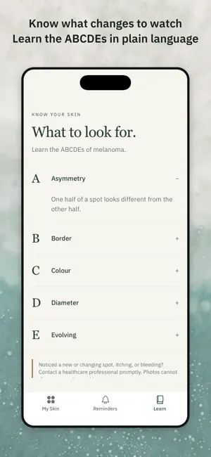 Holey Mole: Skin Tracker screenshot 4
