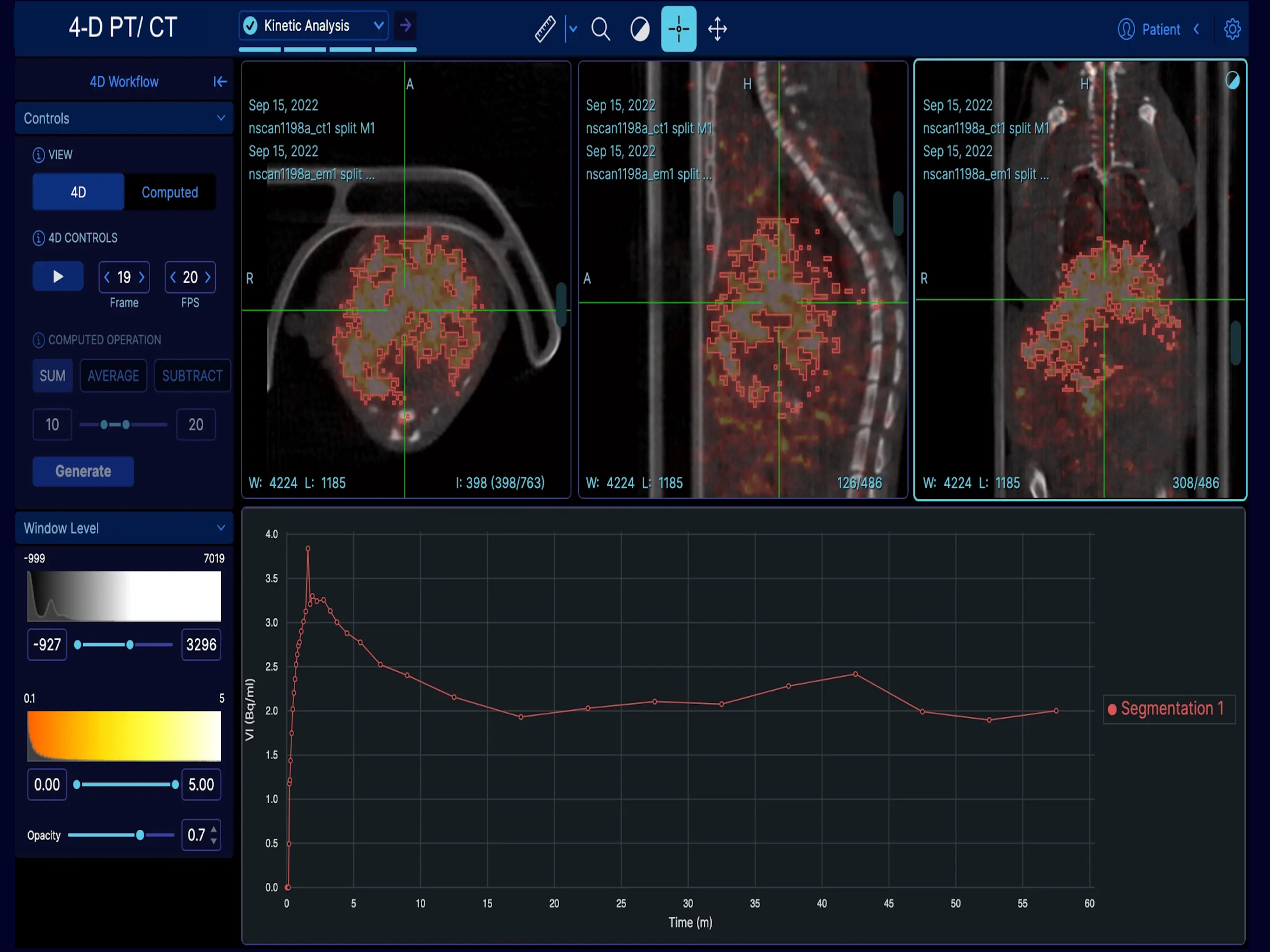 EazyGo | Easy PACS & DICOM screenshot 14