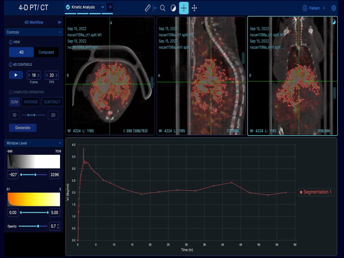 EazyGo  Easy PACS  DICOM