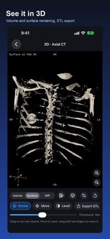 DICOM Viewer: DCM & MRI Reader Screenshot 5 of 6