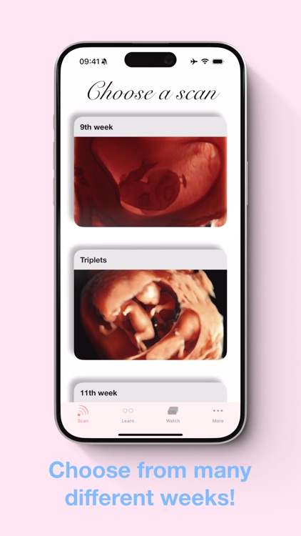 ScanBaby learn baby ultrasound screenshot-3