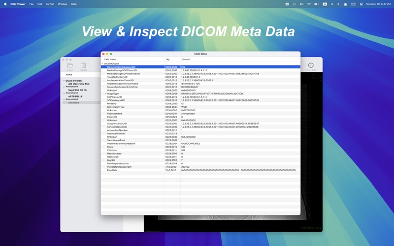 DCM Viewer Screenshot
