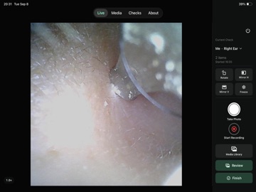 OtoSee: WiFi Otoscope Camera iPad screenshot