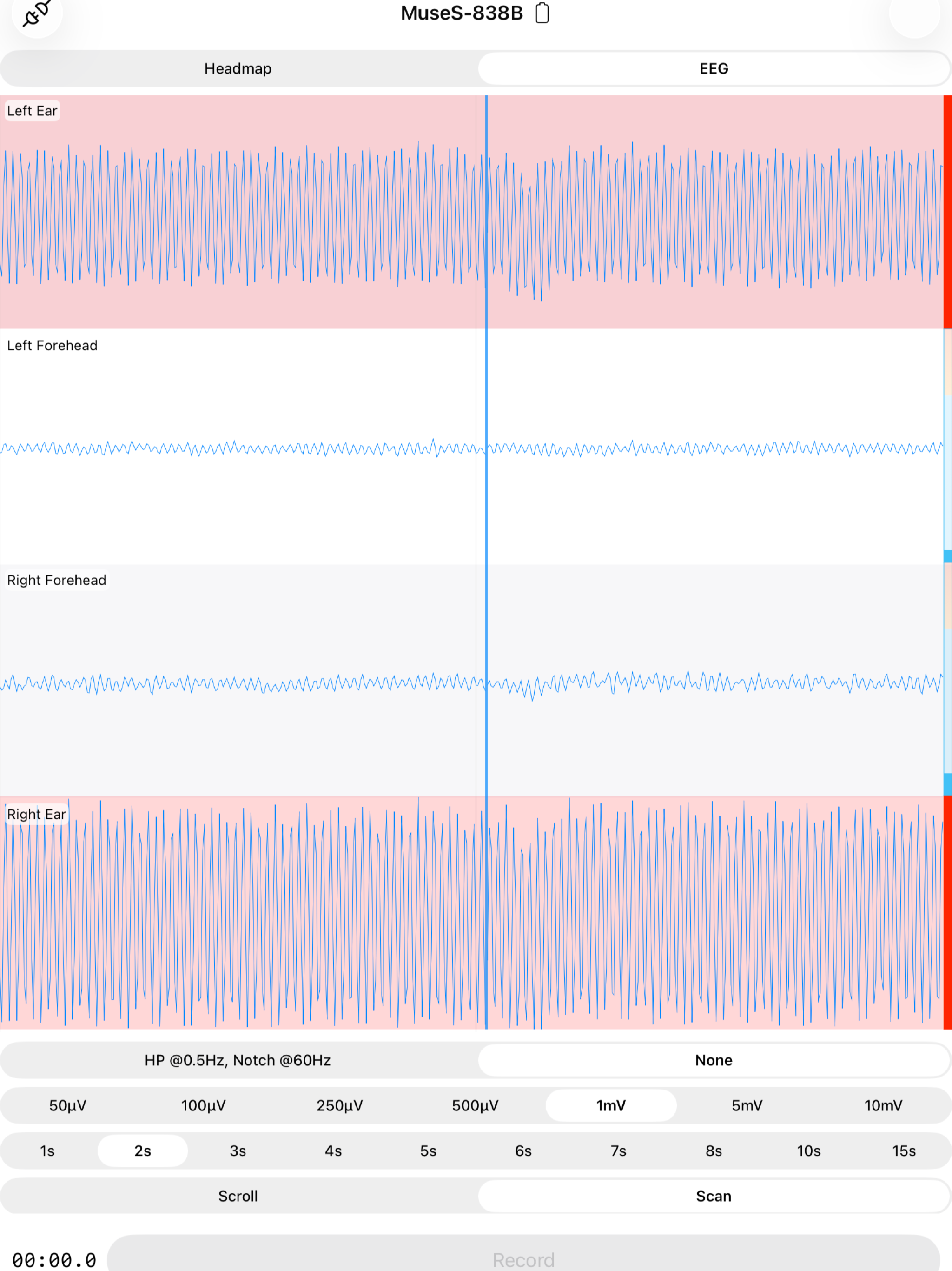 EEG Recorder