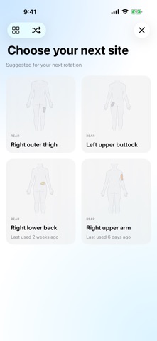 Rotate: Pump & CGM Sites Screenshot 6 of 10