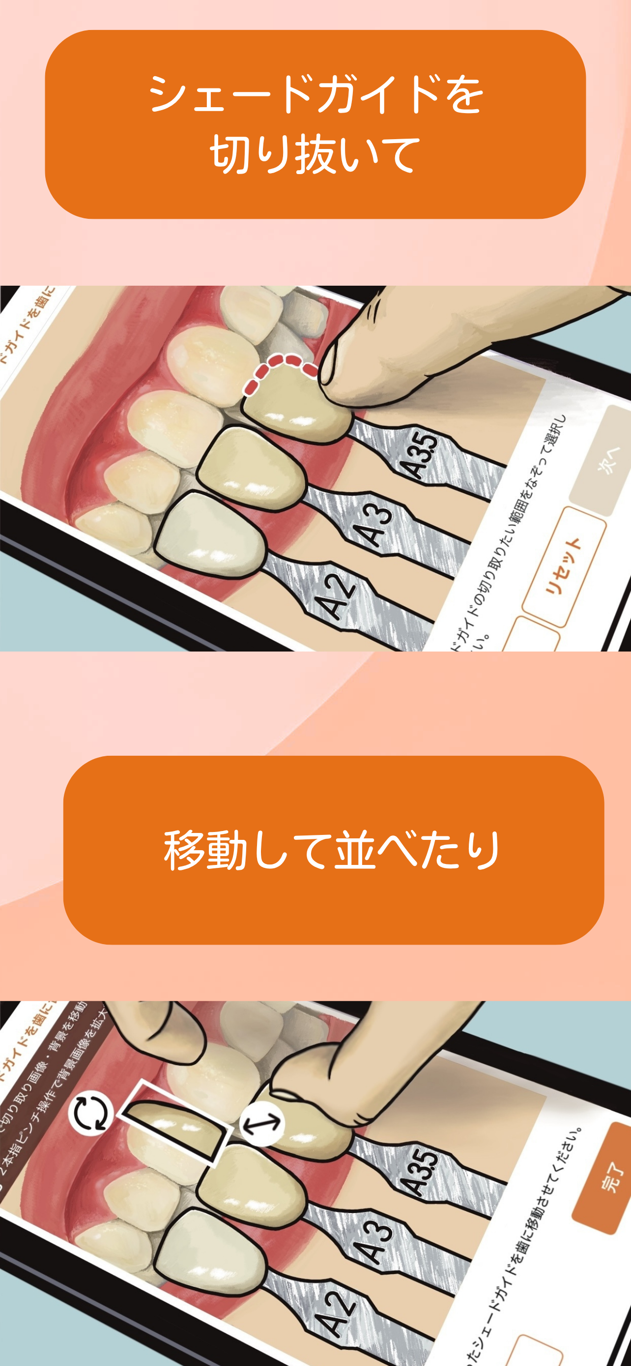 色調採得アシスト