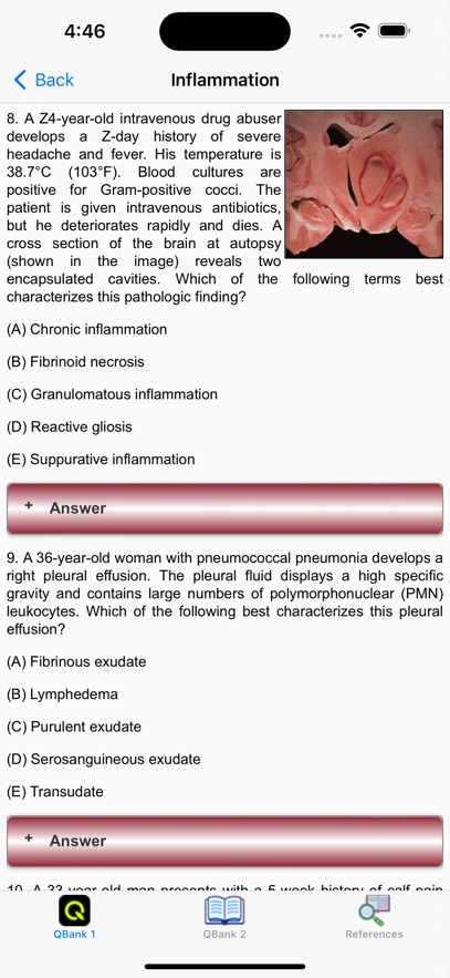Pathology for the USMLE Exams
