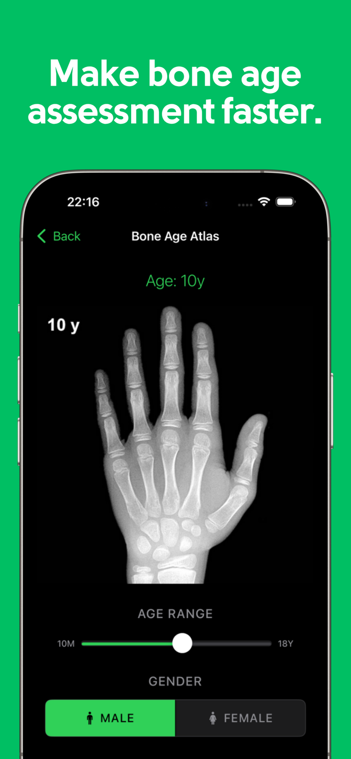 Easy Bone Age Atlas screenshot 1