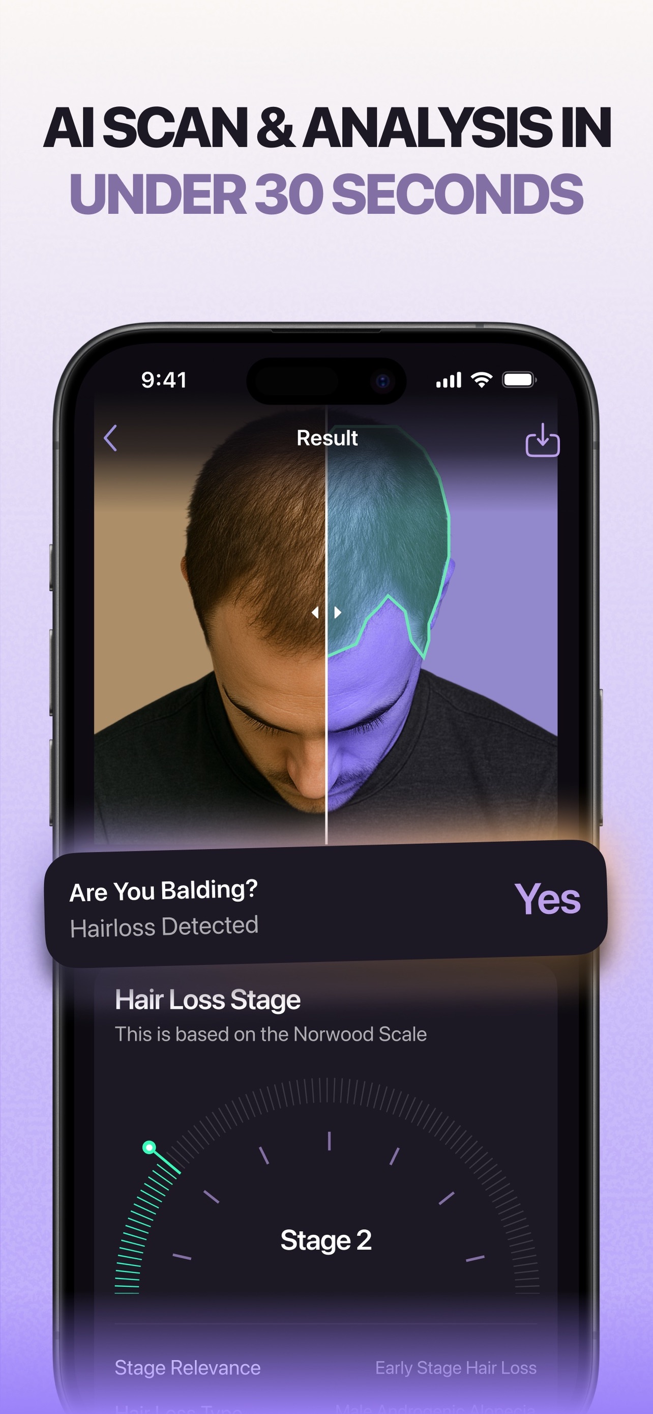 Hair Loss AI: Beat Balding screenshot 3