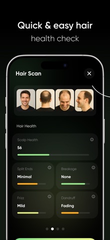 AI Hair Scanner & Health Check iPhone screenshot