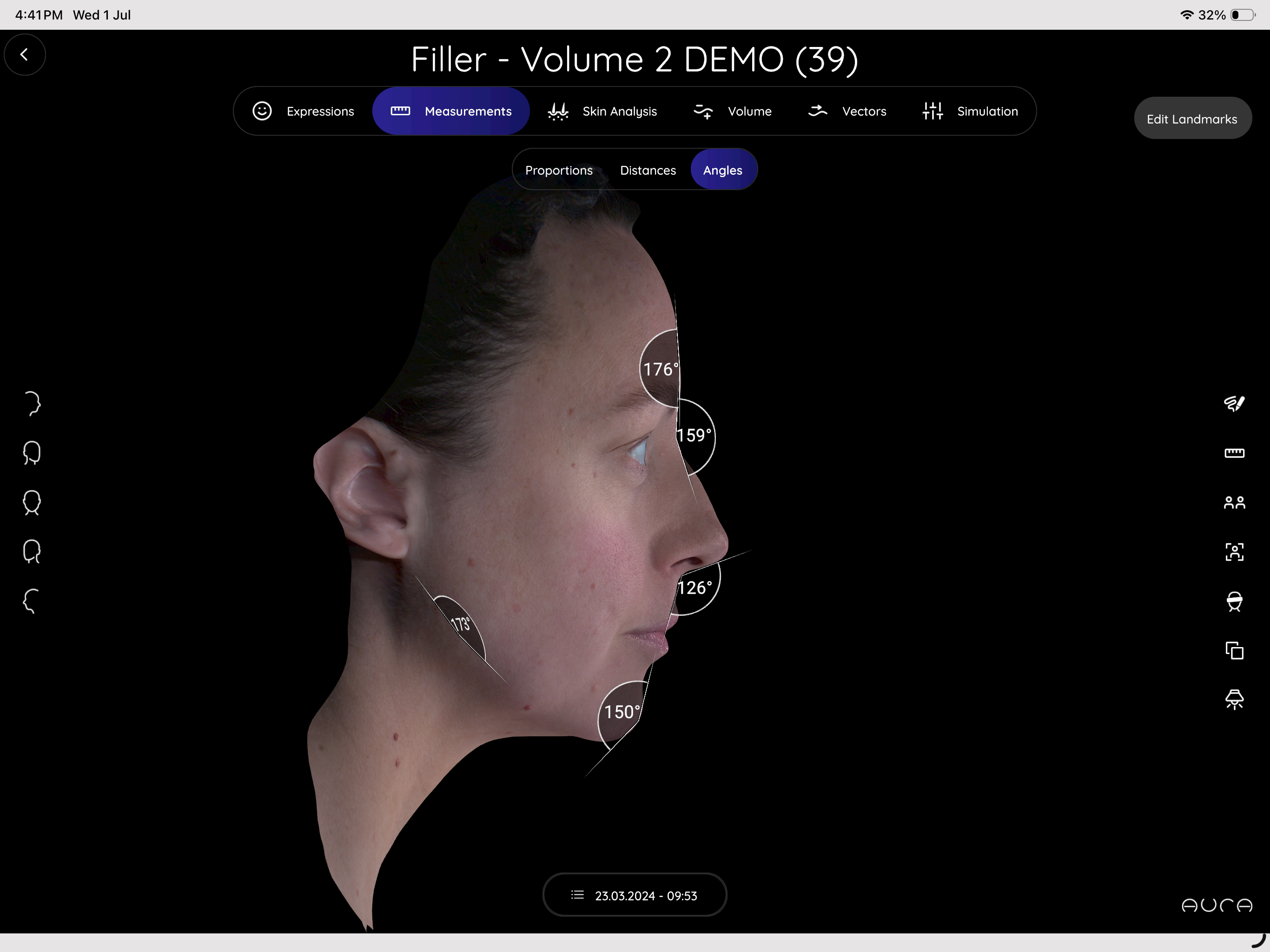 Aura 3D Imaging screenshot 6