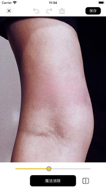 Bear Eraser - AI Remove Object screenshot-3