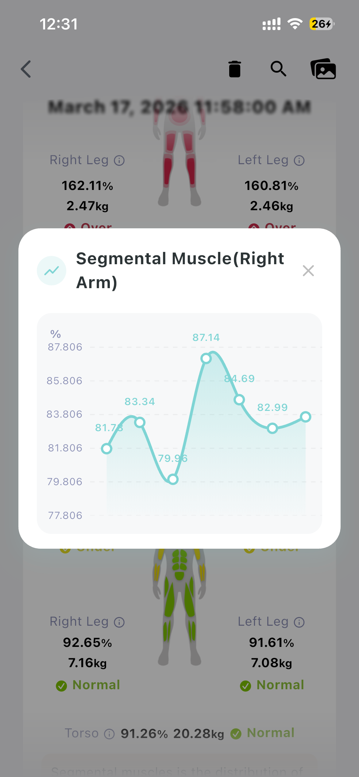 BodyInsight