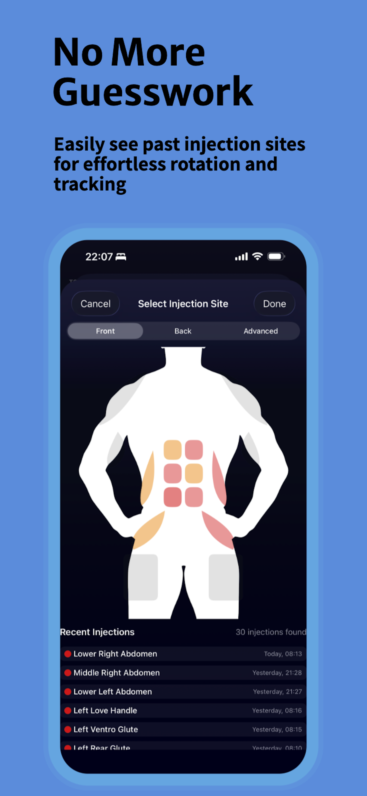 https://is1-ssl.mzstatic.com/image/thumb/PurpleSource221/v4/e1/01/6a/e1016aed-2c08-024e-423b-90d324ab9790/optipin_appstore3.png/1290x2796.png