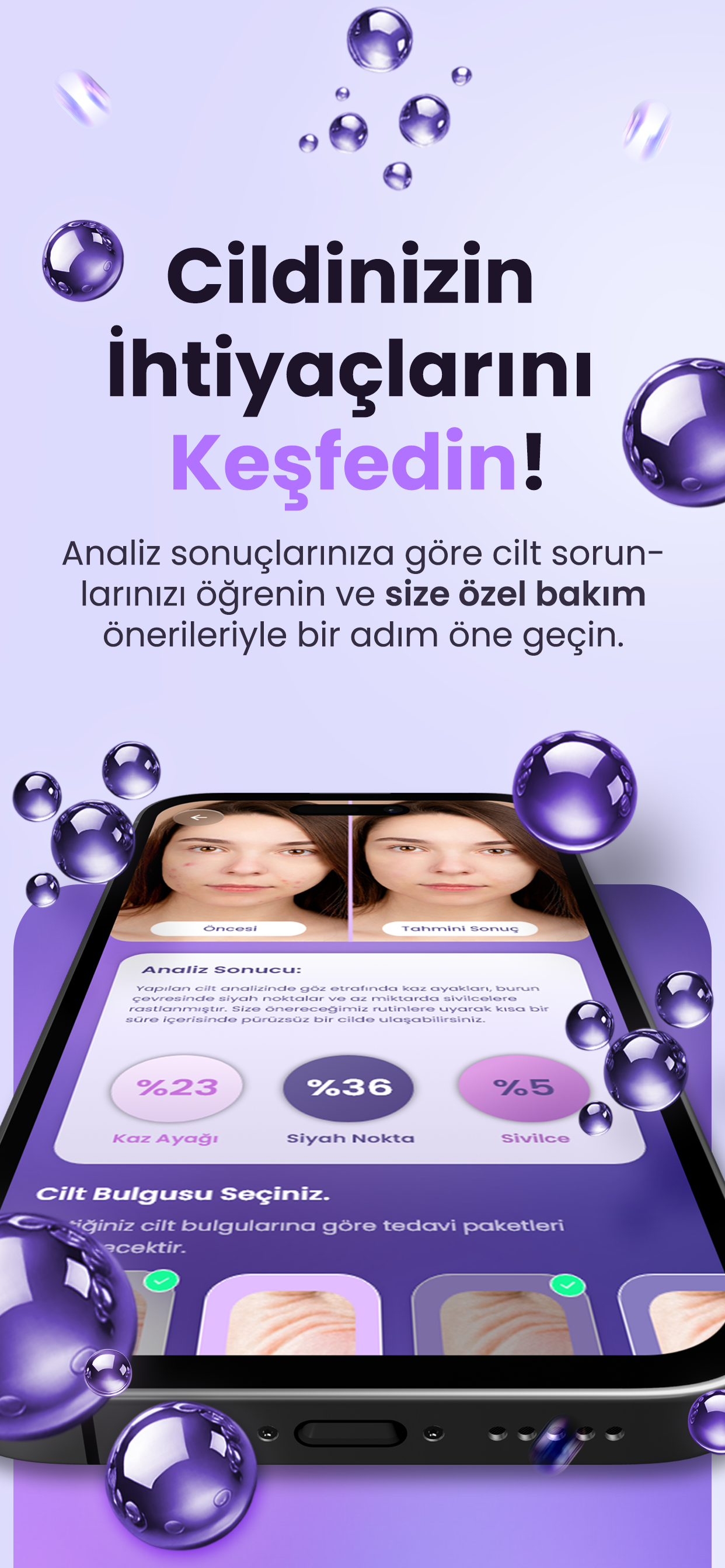 Epiderm AI: Cilt Bakım Analizi