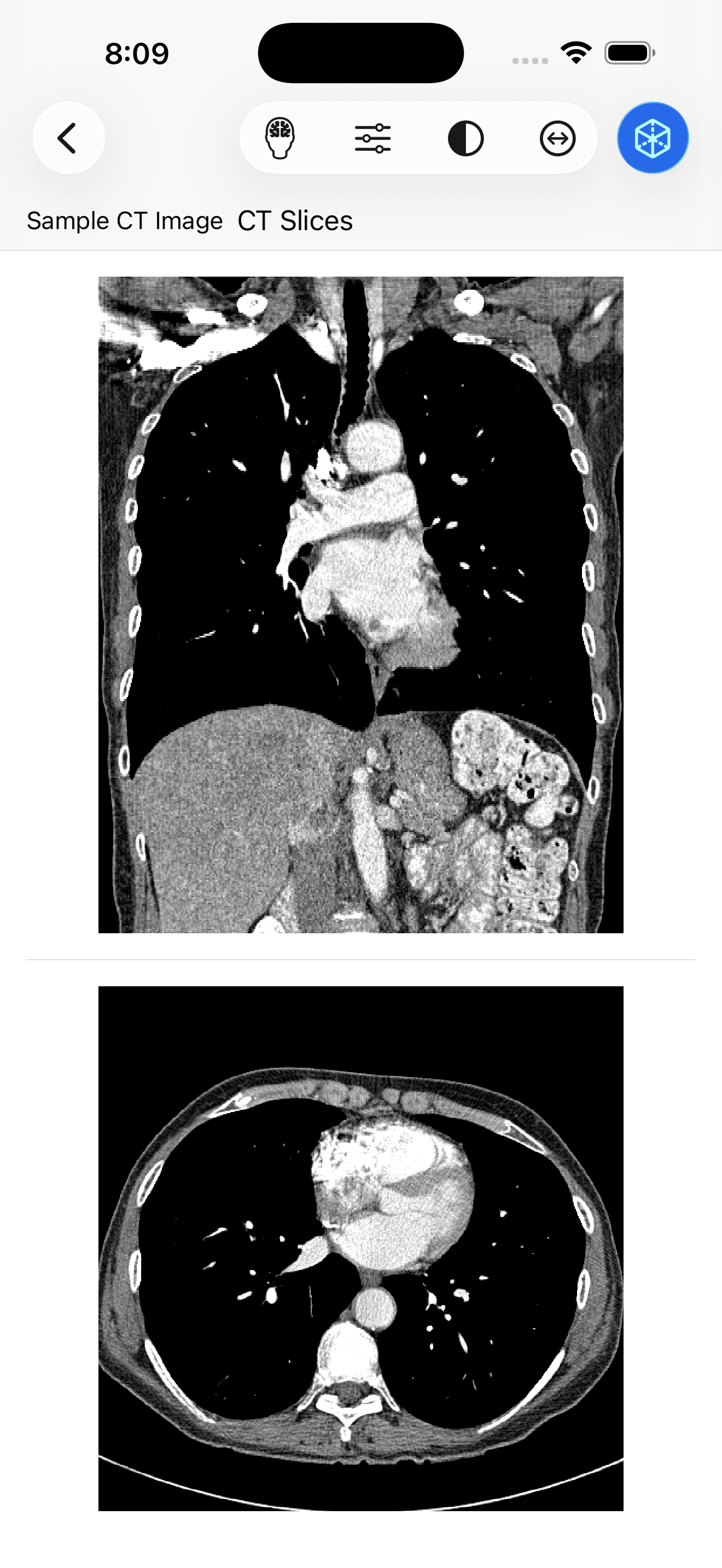 VoxelVision AR Medical Imaging