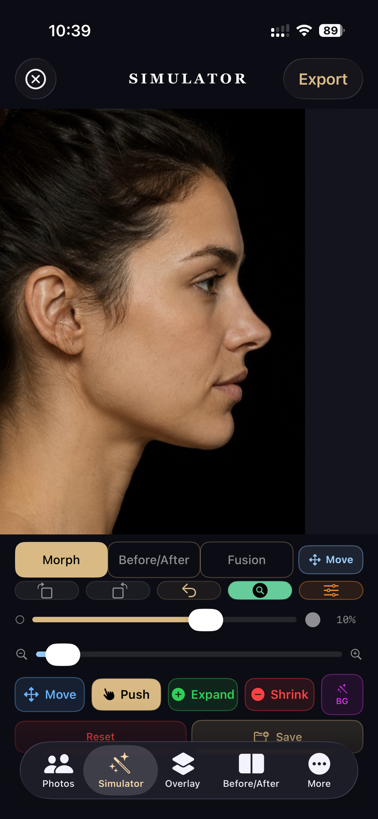 RhinoplastySimulator