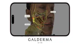 galderma gia external problems & solutions and troubleshooting guide - 3