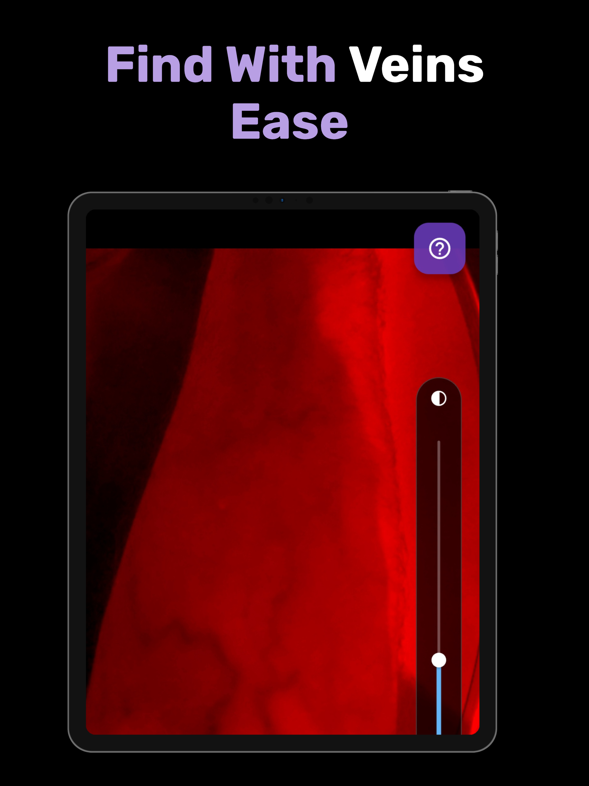 X-Vein pro