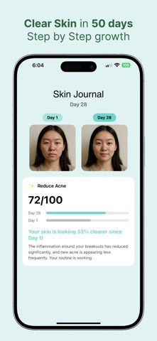 Freya: Skin Analysis & Care iPhone screenshot