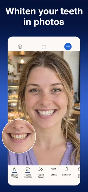 Teeth Whitener: AI Photo Edit screenshot 1