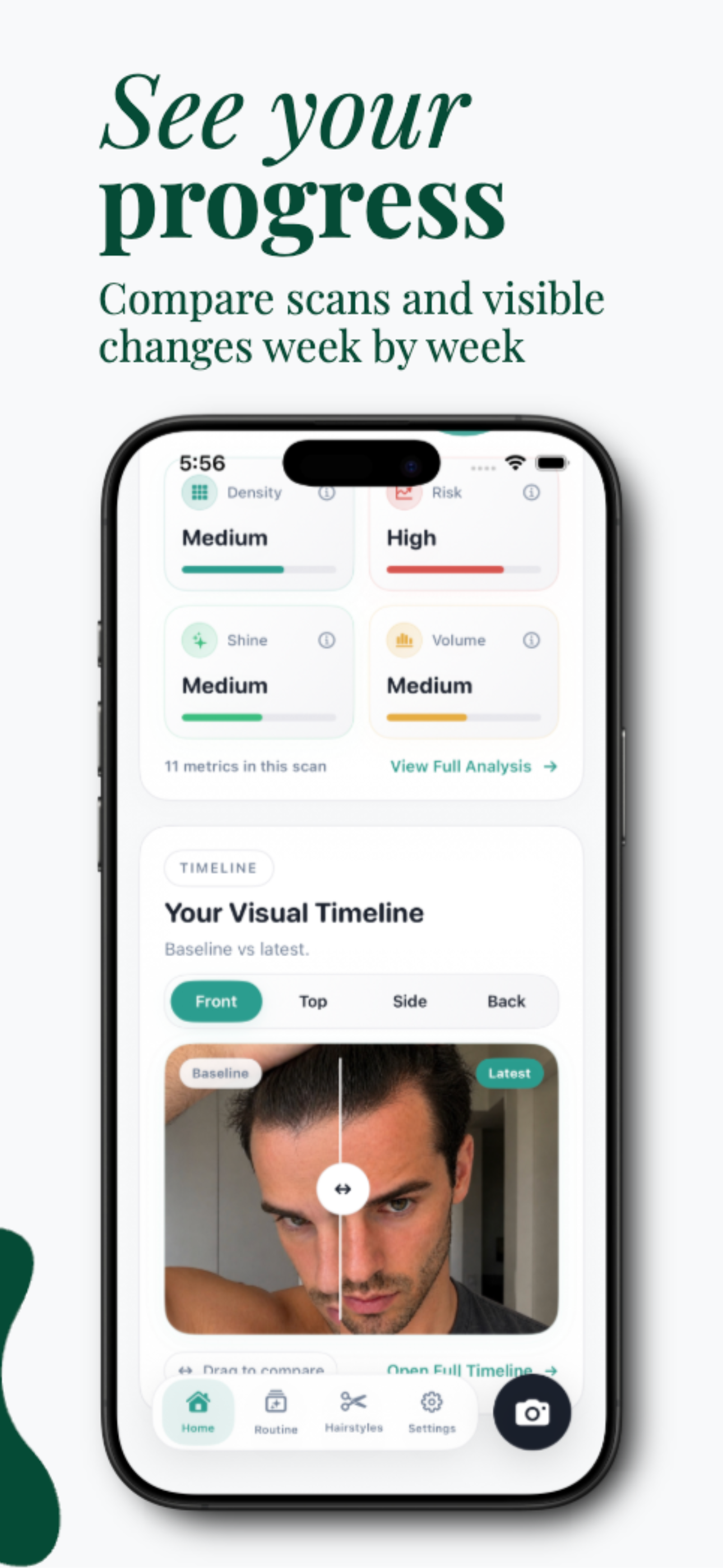HairWise: Hair Loss Tracker