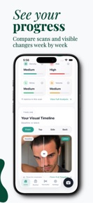 HairWise: Hair Loss Tracker screenshot