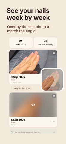 Anxora: Nail Biting & Picking Screenshot 4 of 7